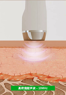 Ultrasonic-img01cn.jpg