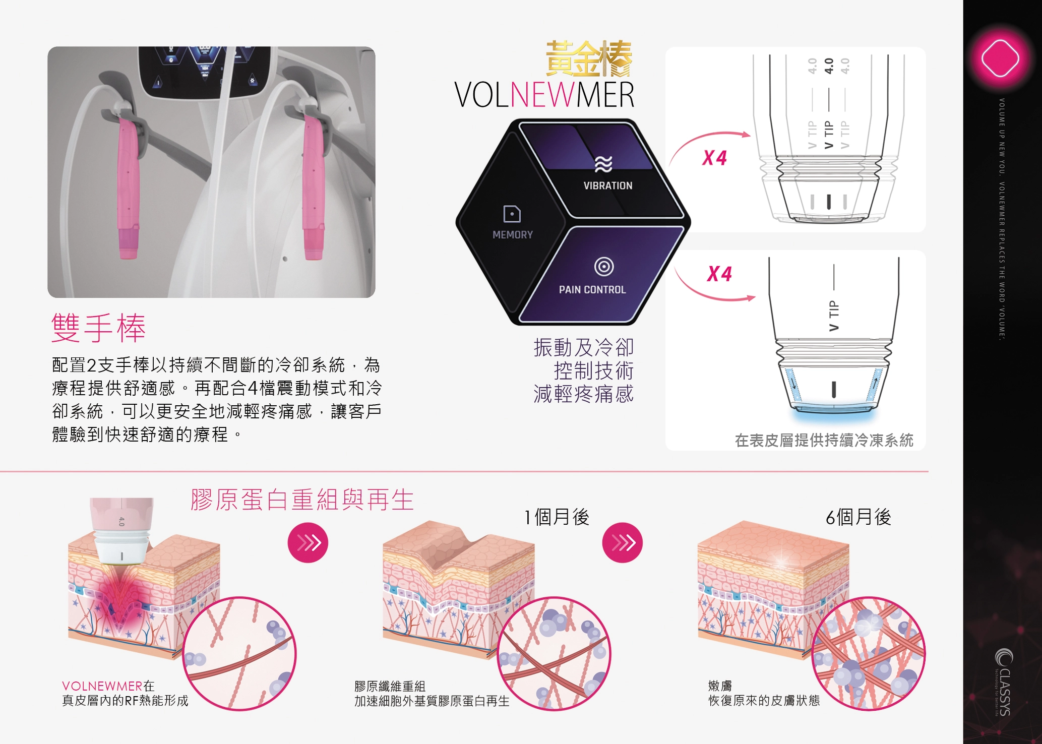 黃金樁FINK-VOLNEWMER_4.jpg