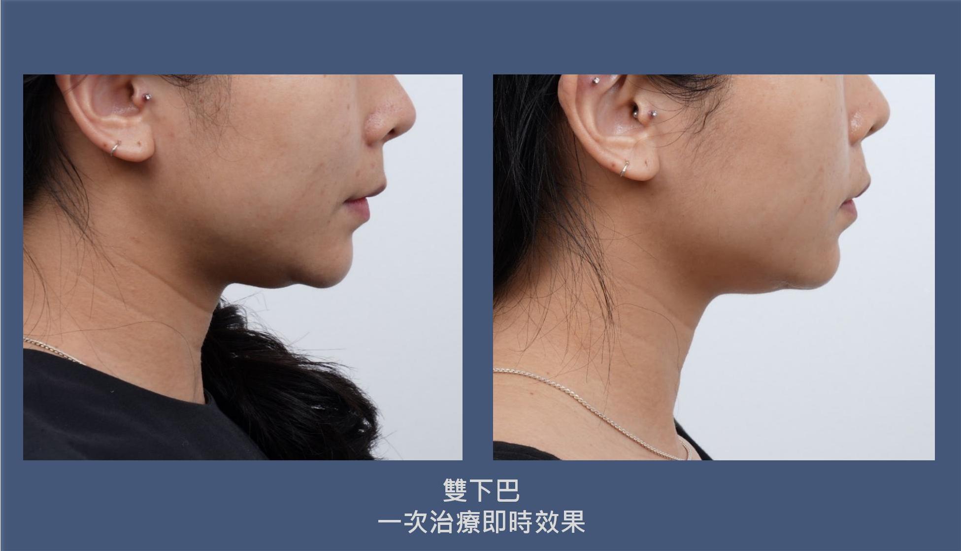 PPT_MPT_DSB - TMOON用_01(13).jpg