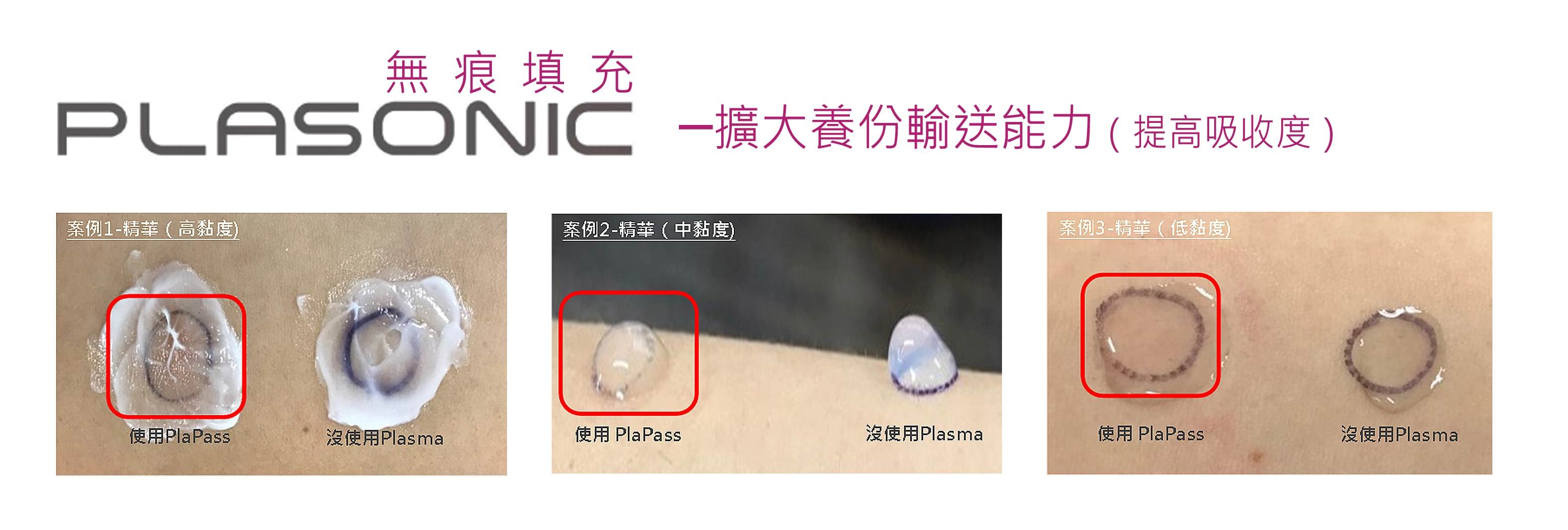 PLASNOb7.jpg