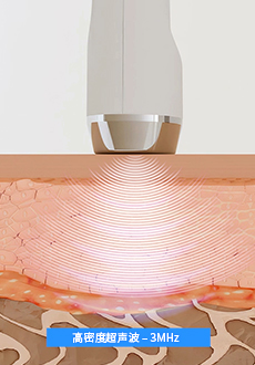 Ultrasonic-img02cn.jpg
