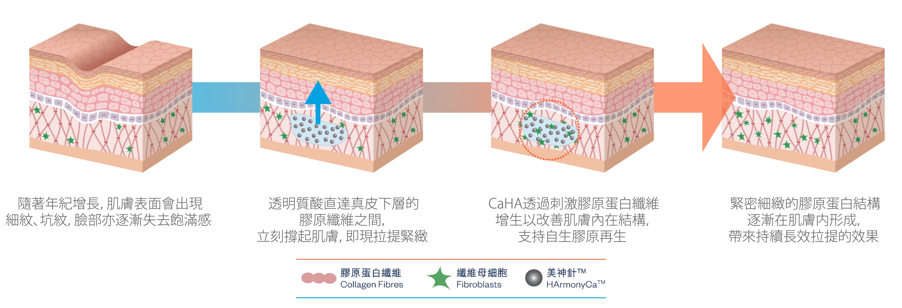 作用機制.jpg